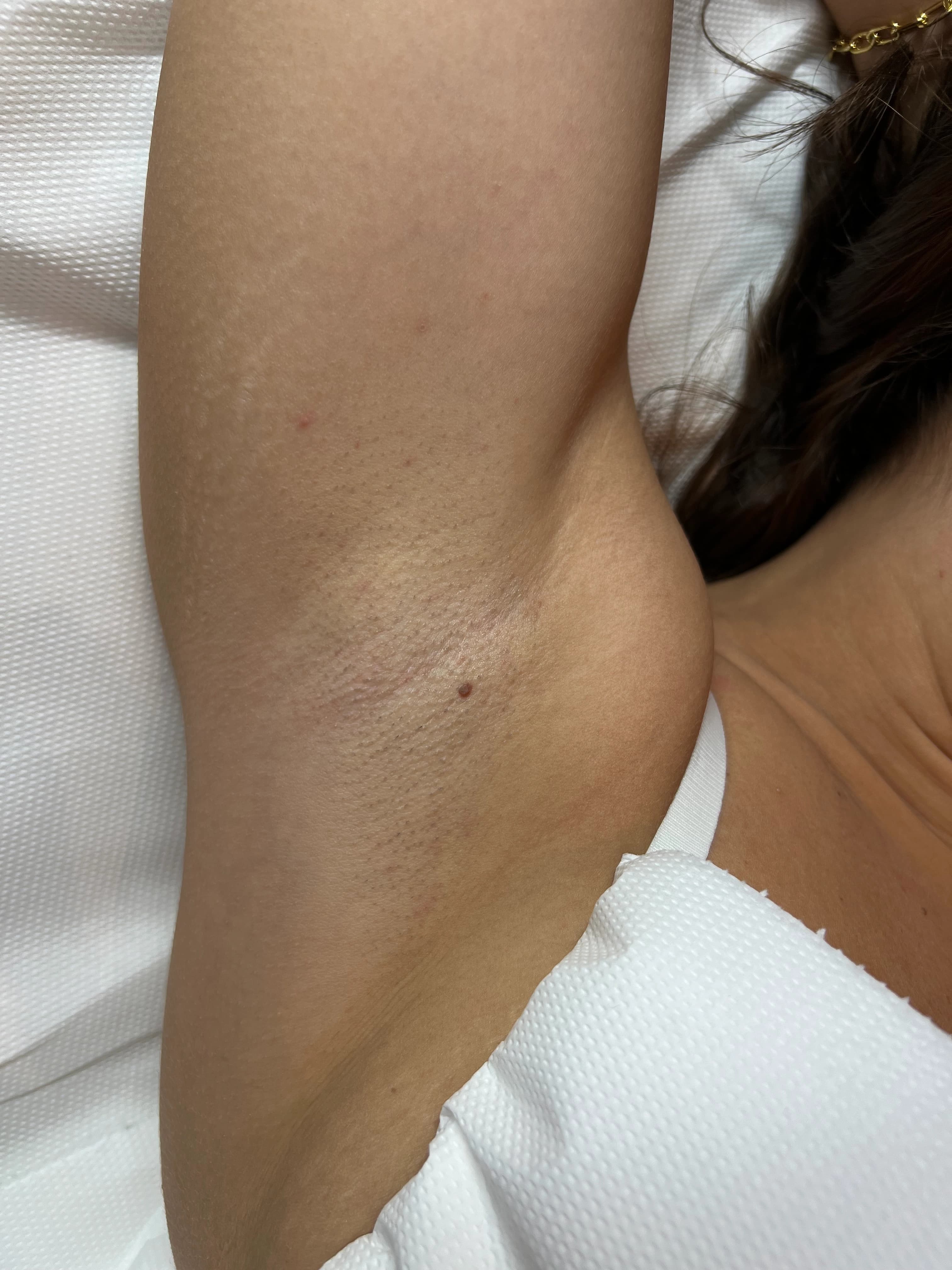 After Treatment